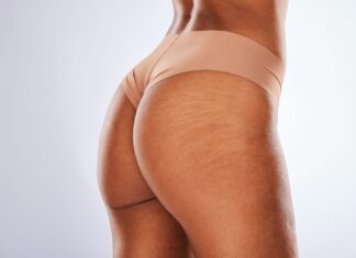 Poznaj skuteczne sposoby na pozbycie się rozstępów