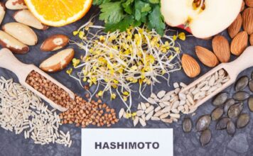 Bunt tarczycy – Hashimoto