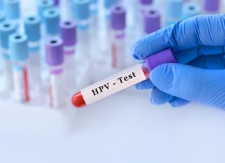 Badanie na HPV – zrób jeszcze przed cytologią!