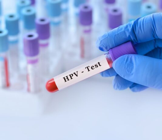 Badanie na HPV – zrób jeszcze przed cytologią!