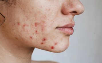 Trendy pielęgnacyjne, które są bardziej szkodliwe niż myślisz