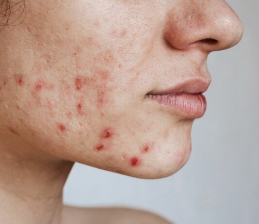 Trendy pielęgnacyjne, które są bardziej szkodliwe niż myślisz