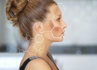 3 rodzaje przebarwień: co je powoduje i jak z nimi walczyć