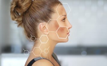 3 rodzaje przebarwień: co je powoduje i jak z nimi walczyć