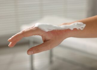 Alantoina i pantenol – duet ratunkowy po słońcu i podrażnieniach