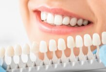 Whitening boom – czy wybielające paski są bezpieczne dla szkliwa?