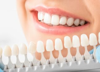 Whitening boom – czy wybielające paski są bezpieczne dla szkliwa?