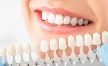 Whitening boom – czy wybielające paski są bezpieczne dla szkliwa?