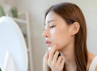 Wakacyjny trądzik: czy SPF-y naprawdę zapychają? I co z tym zrobić?