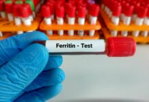 Kiedy zbadać ferrytynę? Włosy, zmęczenie, odporność