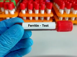 Kiedy zbadać ferrytynę? Włosy, zmęczenie, odporność