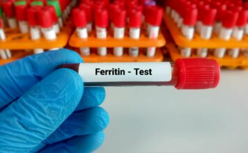 Kiedy zbadać ferrytynę? Włosy, zmęczenie, odporność