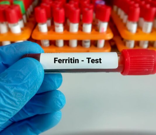 Kiedy zbadać ferrytynę? Włosy, zmęczenie, odporność