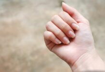 Białe plamki na paznokciach – to nie zawsze brak wapnia