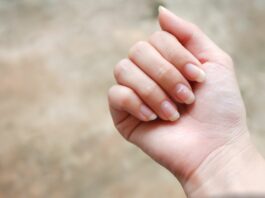 Białe plamki na paznokciach – to nie zawsze brak wapnia