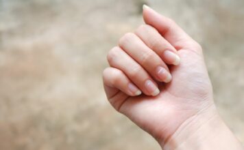 Białe plamki na paznokciach – to nie zawsze brak wapnia