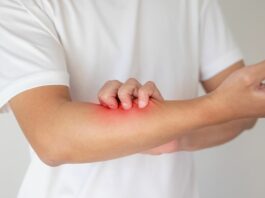 Egzema – dlaczego wraca i co naprawdę ją zaostrza