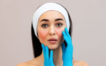 Czego unikać mając cerę naczynkową?