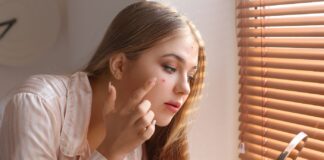 Skuteczne zioła na trądzik