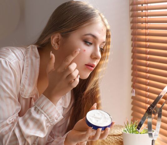 Skuteczne zioła na trądzik