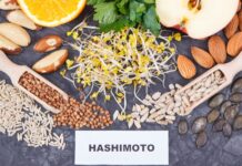 Bunt tarczycy – Hashimoto