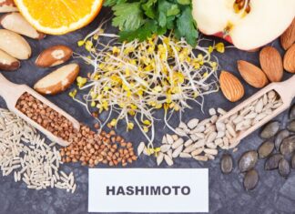 Bunt tarczycy – Hashimoto