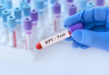 Badanie na HPV – zrób jeszcze przed cytologią!