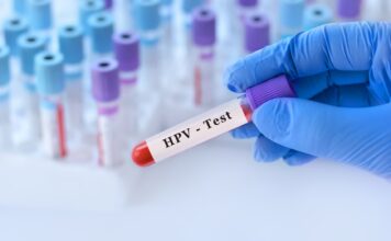 Badanie na HPV – zrób jeszcze przed cytologią!