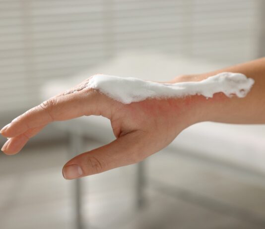 Alantoina i pantenol – duet ratunkowy po słońcu i podrażnieniach