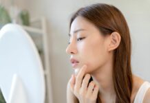 Wakacyjny trądzik: czy SPF-y naprawdę zapychają? I co z tym zrobić?