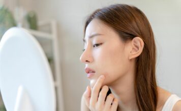 Wakacyjny trądzik: czy SPF-y naprawdę zapychają? I co z tym zrobić?