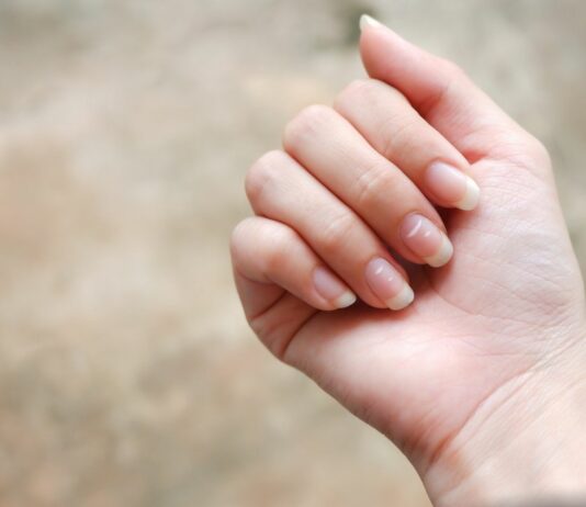 Białe plamki na paznokciach – to nie zawsze brak wapnia