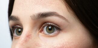 Rumień znikąd? 4 rzeczy, które go podbijają