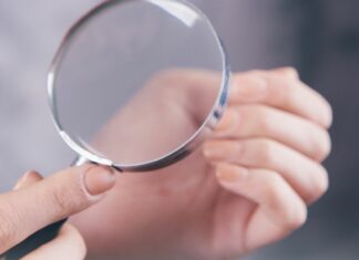 Zielona bakteria na paznokciu. Co to właściwie jest?